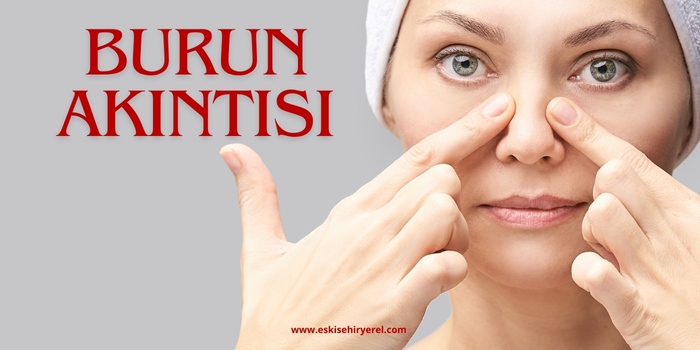Burun Akıntısını Ne Keser? Burun Akıntısına Ne İyi Gelir?
